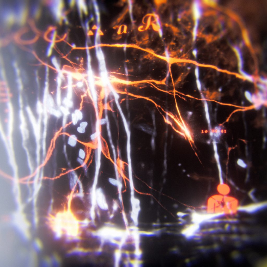 Neural Detergent.